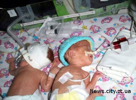 У Житомирі третій тиждень лікарі борються за життя новонароджених дівчаток.