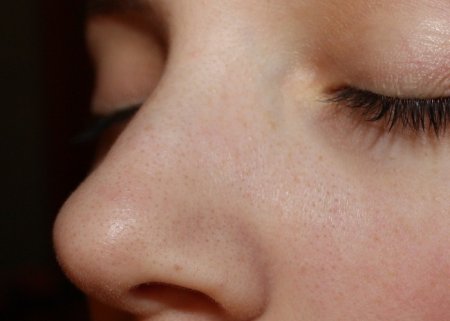 Одна з літніх проблем, яка доставляє масу клопоту - почервонілий ніс на якому лущиться шкіра.