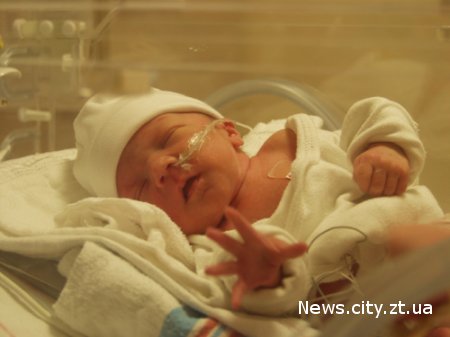 У Житомирі виходжують недоношених малюків вагою від 500 грамів.